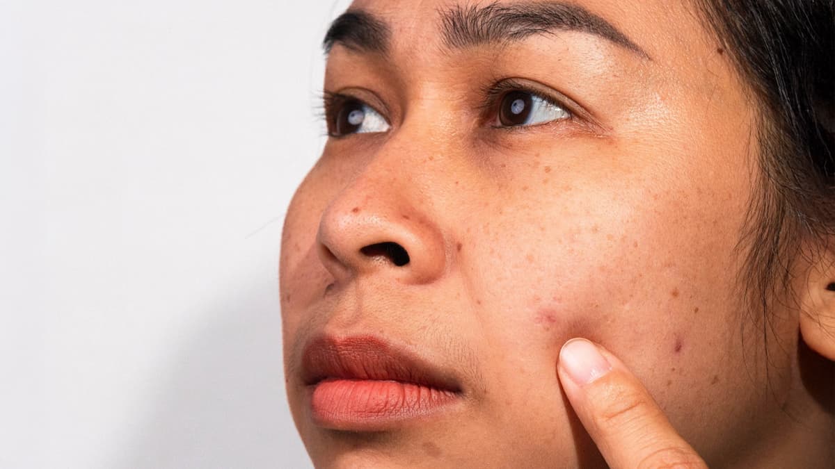 Why Is My Skin Dull?