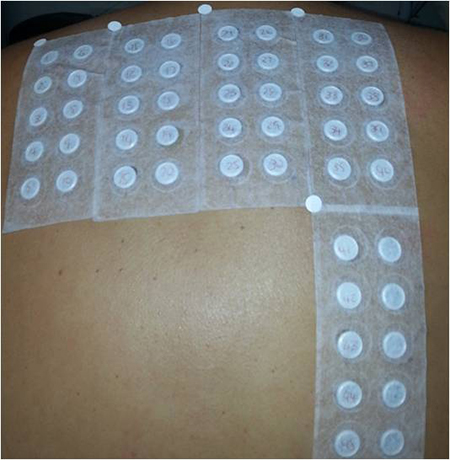 Patch Test