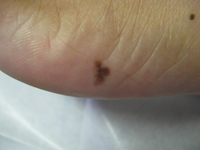 Mole Under Foot